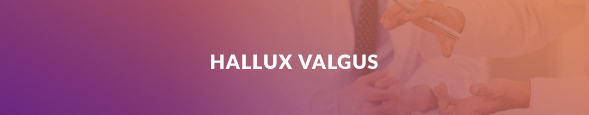 hallux-valgus